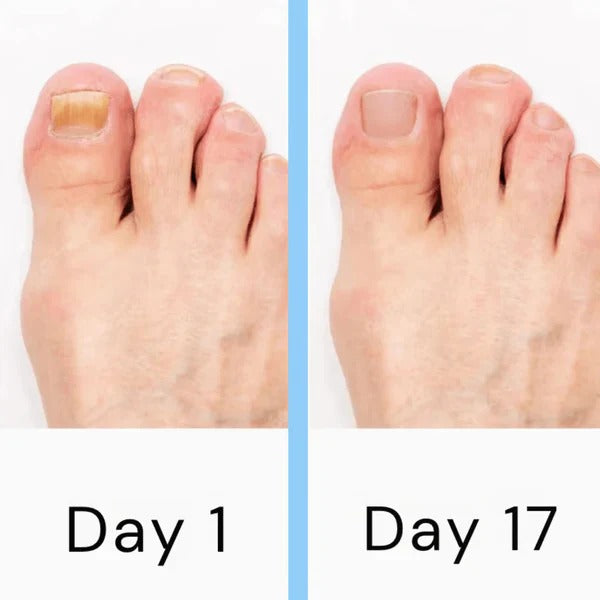 Electric Nail Care Device – Portable Rechargeable Grooming Tool