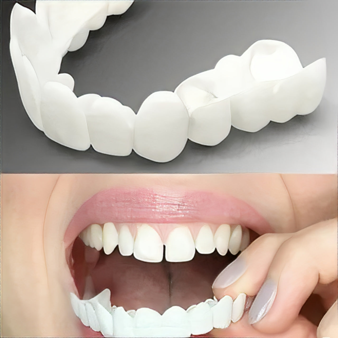Adjustable Cosmetic Smile Veneers, Upper & Lower Set