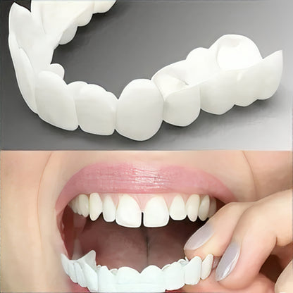 Adjustable Cosmetic Smile Veneers, Upper & Lower Set