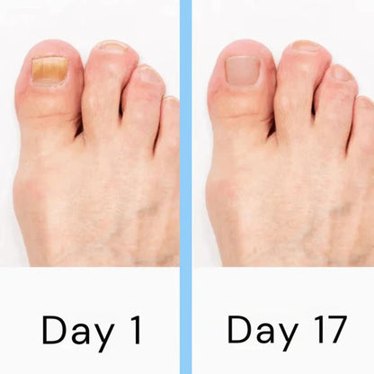 Electric Nail Care Device – Portable Rechargeable Grooming Tool